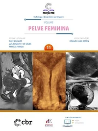 Coleção CBR Volume 11 Pelve Feminina: Coleção CBR Radiologia e Diagnóstico por Imagem
