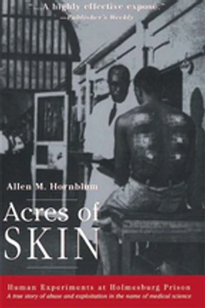 Acres of Skin: Human Experiments at Holmesburg Prison