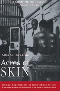 Acres of Skin: Human Experiments at Holmesburg Prison