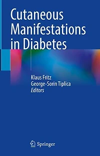 Cutaneous Manifestations Diabetes