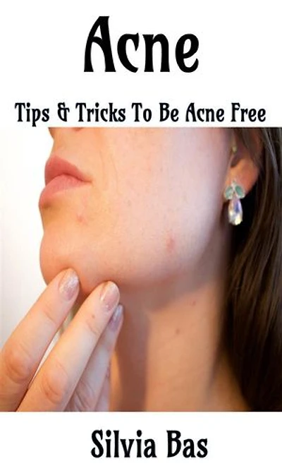 Acne: Tips & Tricks To Be Acne Free