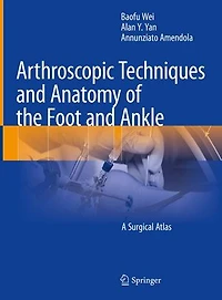 Arthroscopic Techniques and Anatomy of the Foot Ankle: A Surgical Atlas