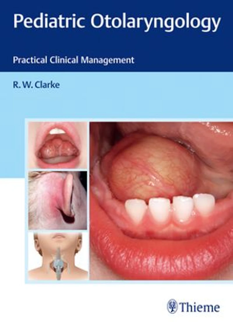 Pediatric Otolaryngology: Practical Clinical Management