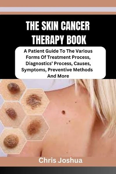 THE SKIN CANCER THERAPY BOOK: A Patient Guide To The Various Forms Of Treatment Process, Diagnostics’ Process, Causes, Symptoms, Preventive Methods And More