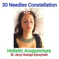 30 Needles Constellation Acupuncture: Holistic Acupuncture