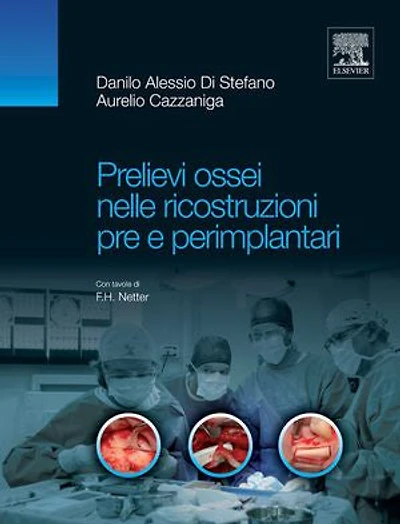 Prelievi ossei nelle ricostruzioni pre e perimplantari