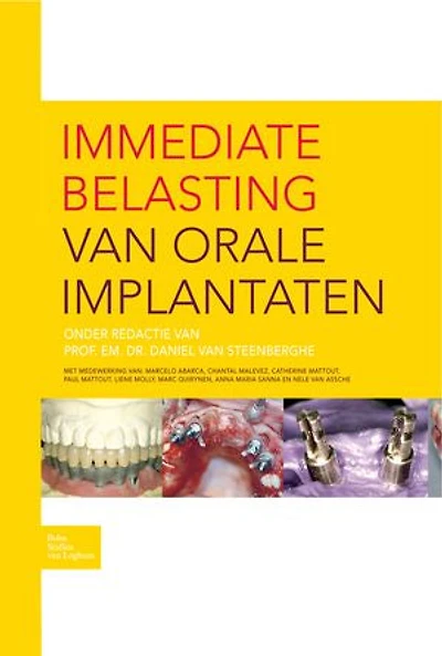 Immediate belasting van orale implantaten