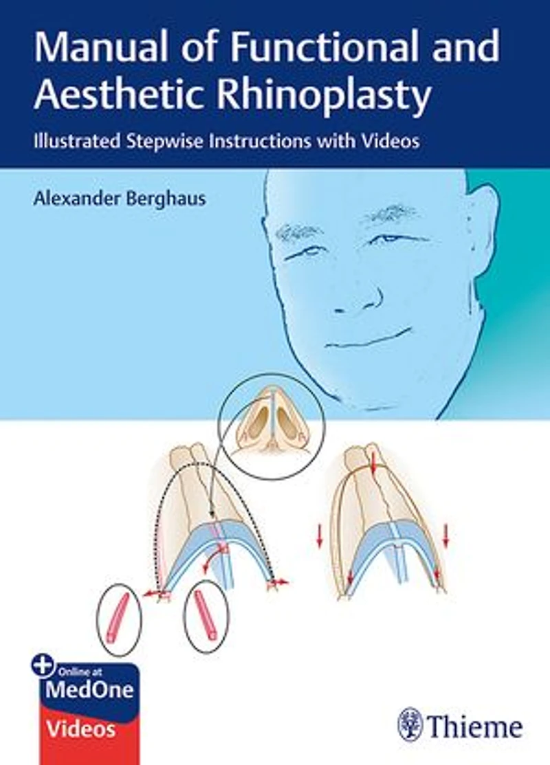 Manual of Functional and Aesthetic Rhinoplasty: Illustrated Stepwise Instructions with Videos