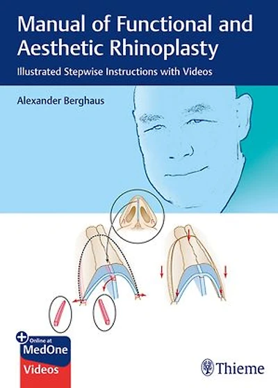 Manual of Functional and Aesthetic Rhinoplasty: Illustrated Stepwise Instructions with Videos
