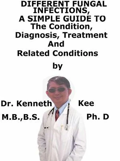 Different Fungal Infections, A Simple Guide To The Condition, Diagnosis, Treatment And Related Conditions