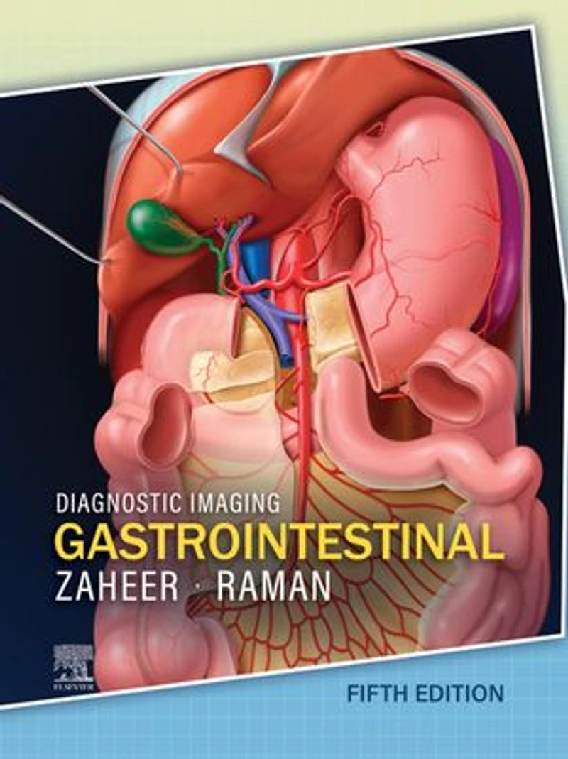 Diagnostic Imaging: Gastrointestinal