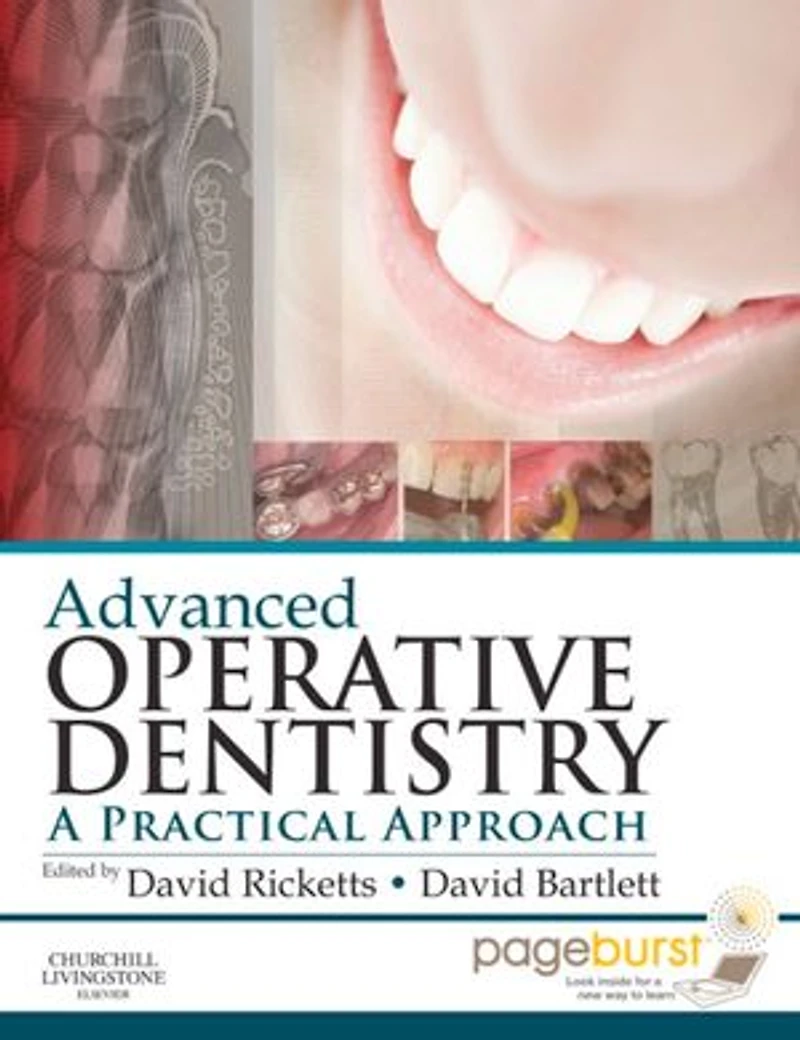 Advanced Operative Dentistry: A Practical Approach