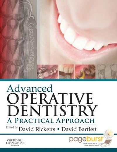 Advanced Operative Dentistry: A Practical Approach