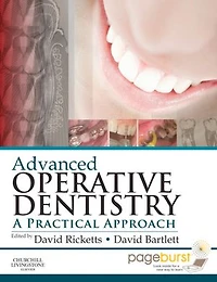 Advanced Operative Dentistry: A Practical Approach