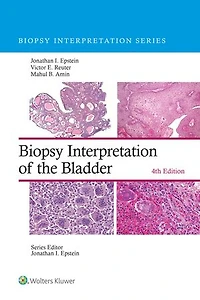 Biopsy Interpretation of the Bladder: Print + eBook with Multimedia