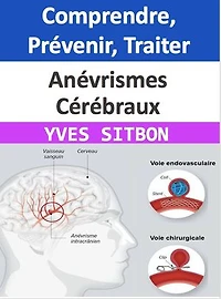 Anévrismes Cérébraux : Comprendre, Prévenir, Traiter: Un Guide Complexe pour la Gestion et l'Éducation autour des Anévrismes Cérébraux