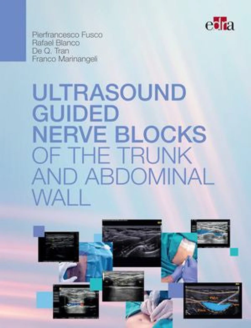 Ultrasoundguided nerve blocks of the trunk and abdominal wall