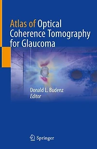 Atlas of Optical Coherence Tomography for Glaucoma