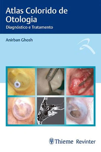 Atlas Colorido de Otologia: Diagnóstico e Tratamento