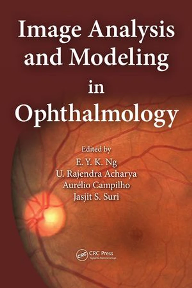 Image Analysis and Modeling Ophthalmology