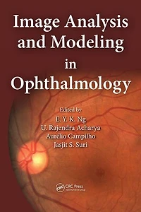 Image Analysis and Modeling Ophthalmology