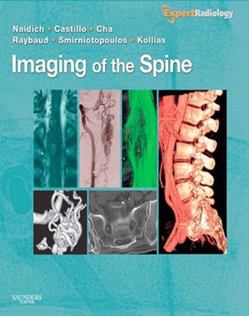 Imaging Of The Spine: Expert Radiology Series