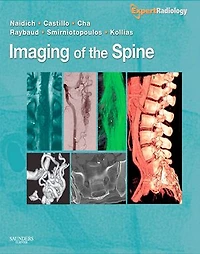 Imaging Of The Spine: Expert Radiology Series