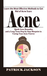 Acne: Learn the Most Effective Methods to Get Rid of Acne Scars (Quick Acne Remedies and a Long Term Step by Step Blueprint in Curing Your Acne Forever)