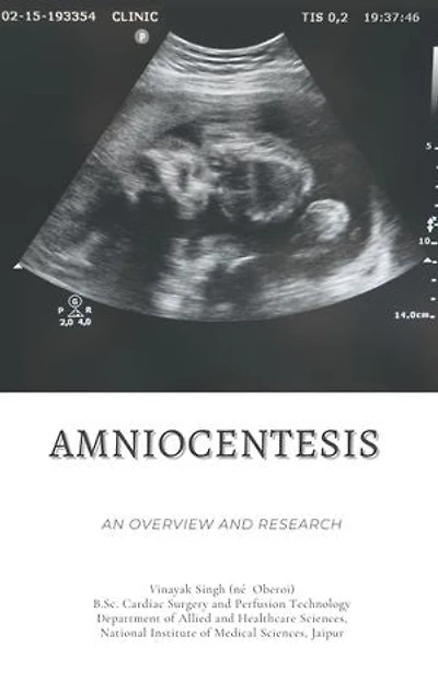 Amniocentesis: An Overview and Research