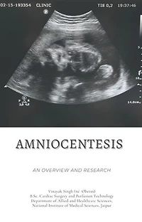 Amniocentesis: An Overview and Research