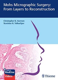 Mohs Micrographic Surgery: From Layers To Reconstruction