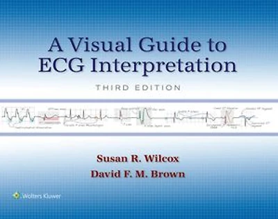 A Visual Guide to ECG Interpretation: Print + eBook with Multimedia