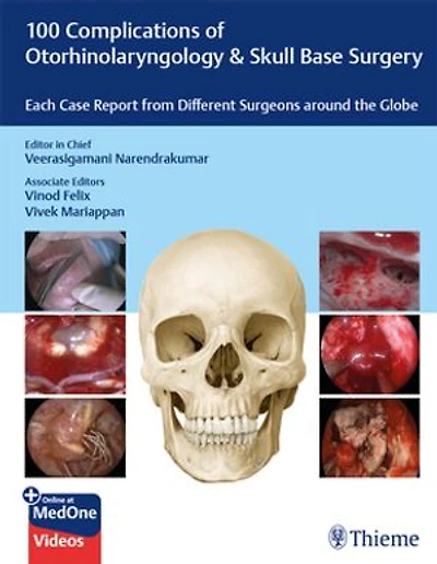 100 Complications of Otorhinolangyngology & Skull Base Surgery: Each Case Report from Different Surgeons around the Globe