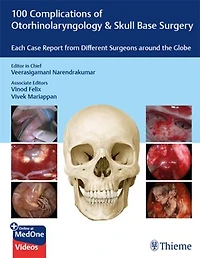 100 Complications of Otorhinolangyngology & Skull Base Surgery: Each Case Report from Different Surgeons around the Globe