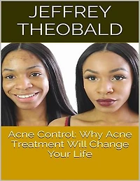 Acne Control: Why Acne Treatment Will Change Your Life