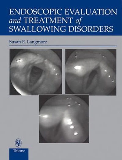 Endoscopic Evaluation and Treatment of Swallowing Disorders