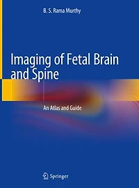 Imaging Of Fetal Brain And Spine: An Atlas Guide
