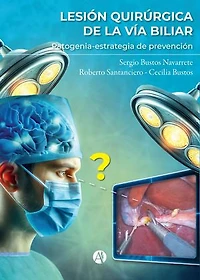 Lesión quirúrgica de la vía biliar: Patogenia-estrategia de prevención
