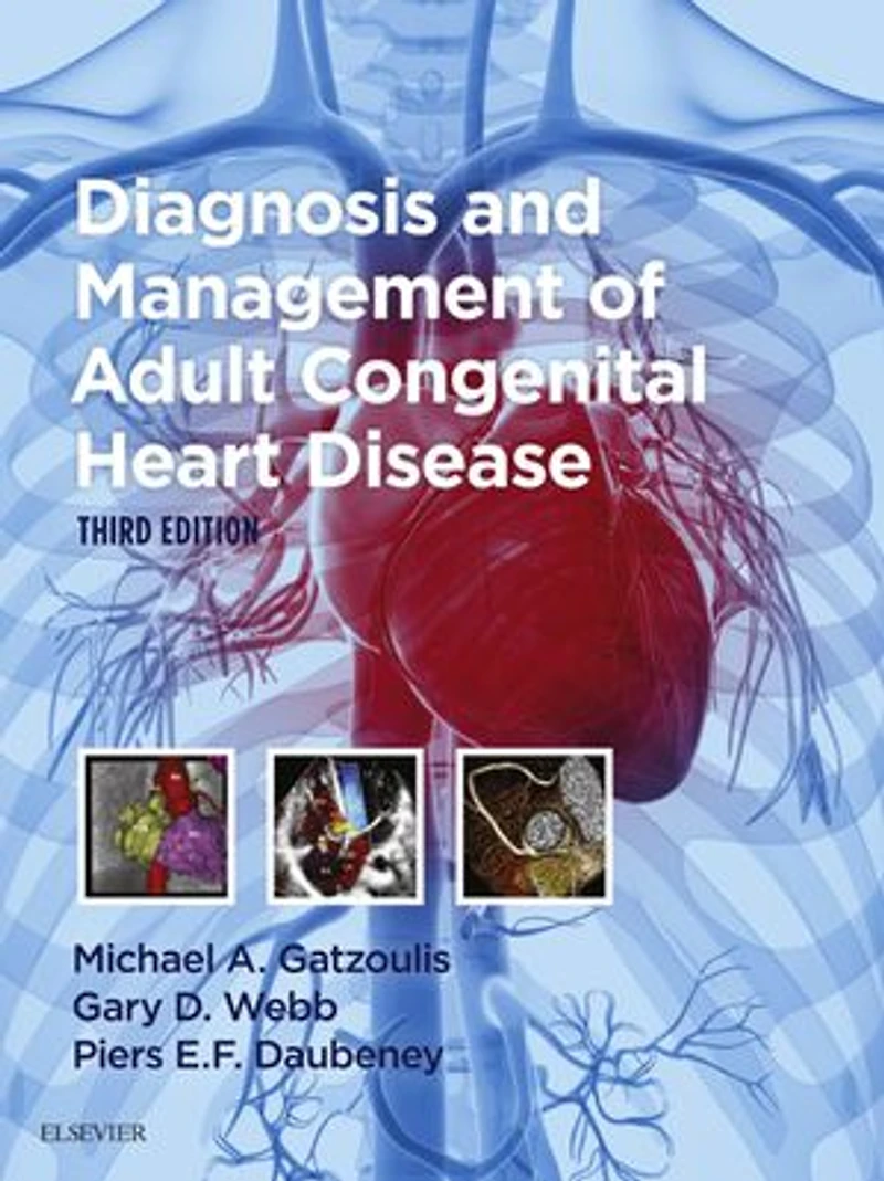 Diagnosis and Management of Adult Congenital Heart Disease