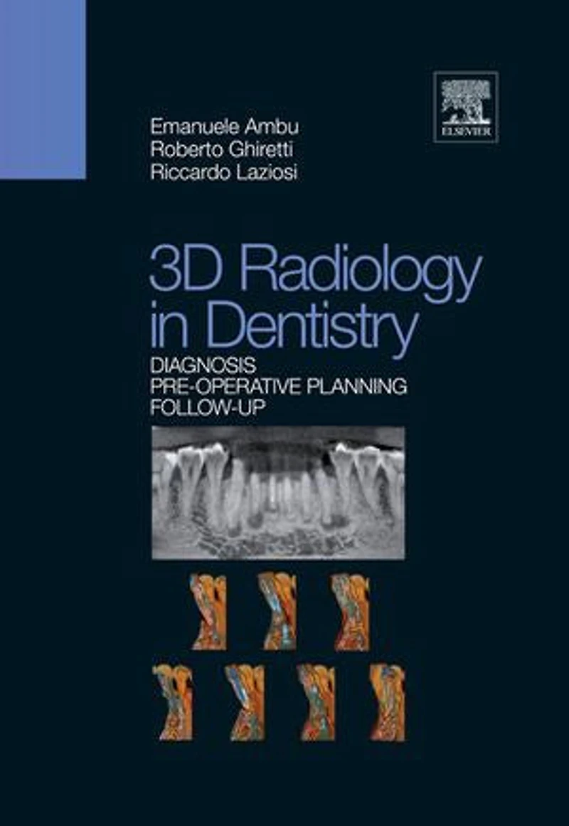 3D Radiology Dentistry - Diagnosis Pre-Operative Planning Follow-Up