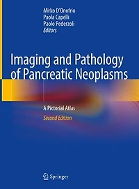 Imaging and Pathology of Pancreatic Neoplasms: A Pictorial Atlas