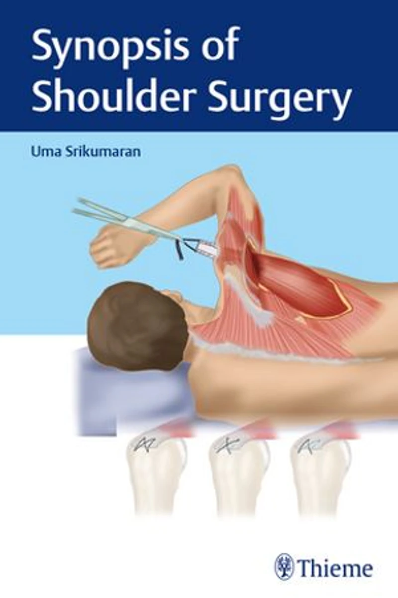 Synopsis Of Shoulder Surgery