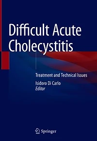 Difficult Acute Cholecystitis: Treatment And Technical Issues
