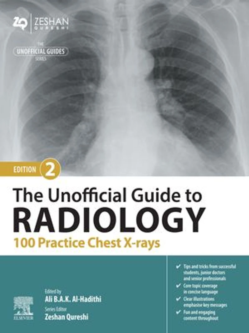 The Unofficial Guide to Radiology: 100 Practice Chest X-Rays