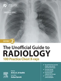 The Unofficial Guide to Radiology: 100 Practice Chest X-Rays