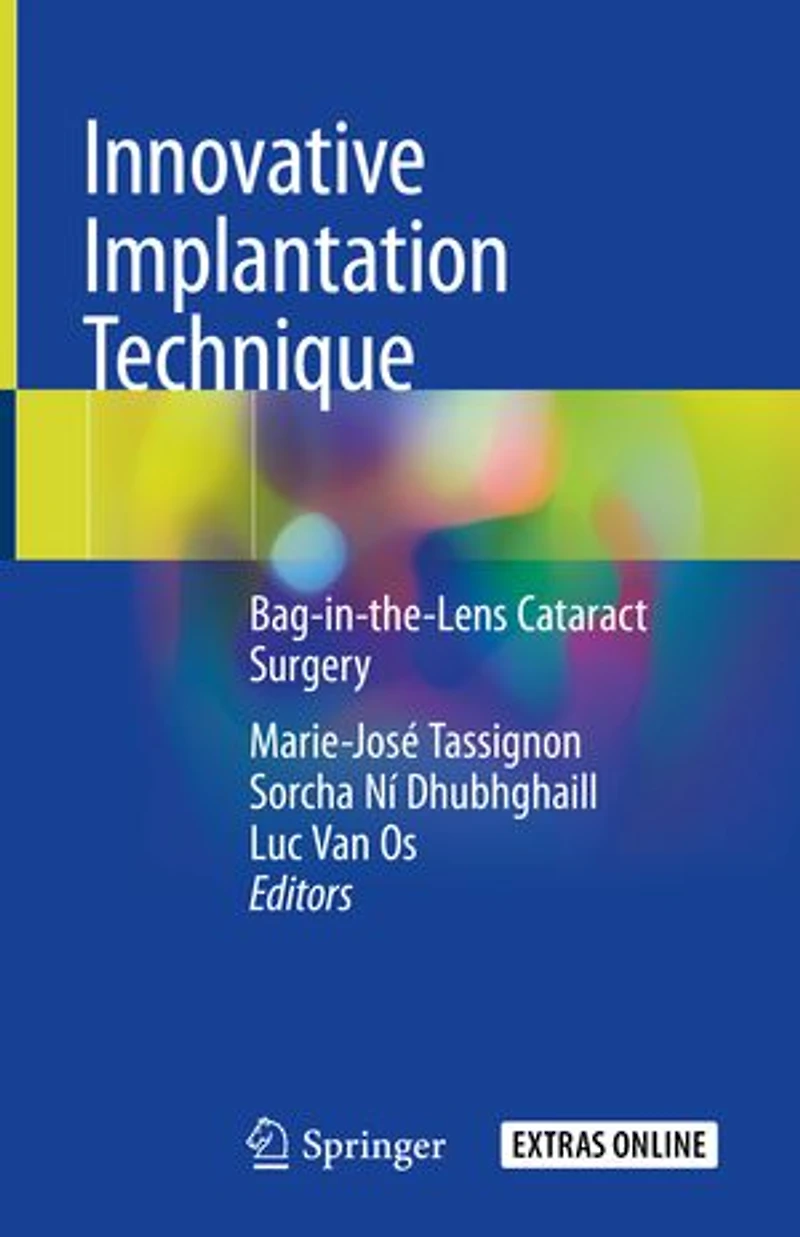 Innovative Implantation Technique: Bag-in-the-lens Cataract Surgery