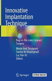 Innovative Implantation Technique: Bag-in-the-lens Cataract Surgery
