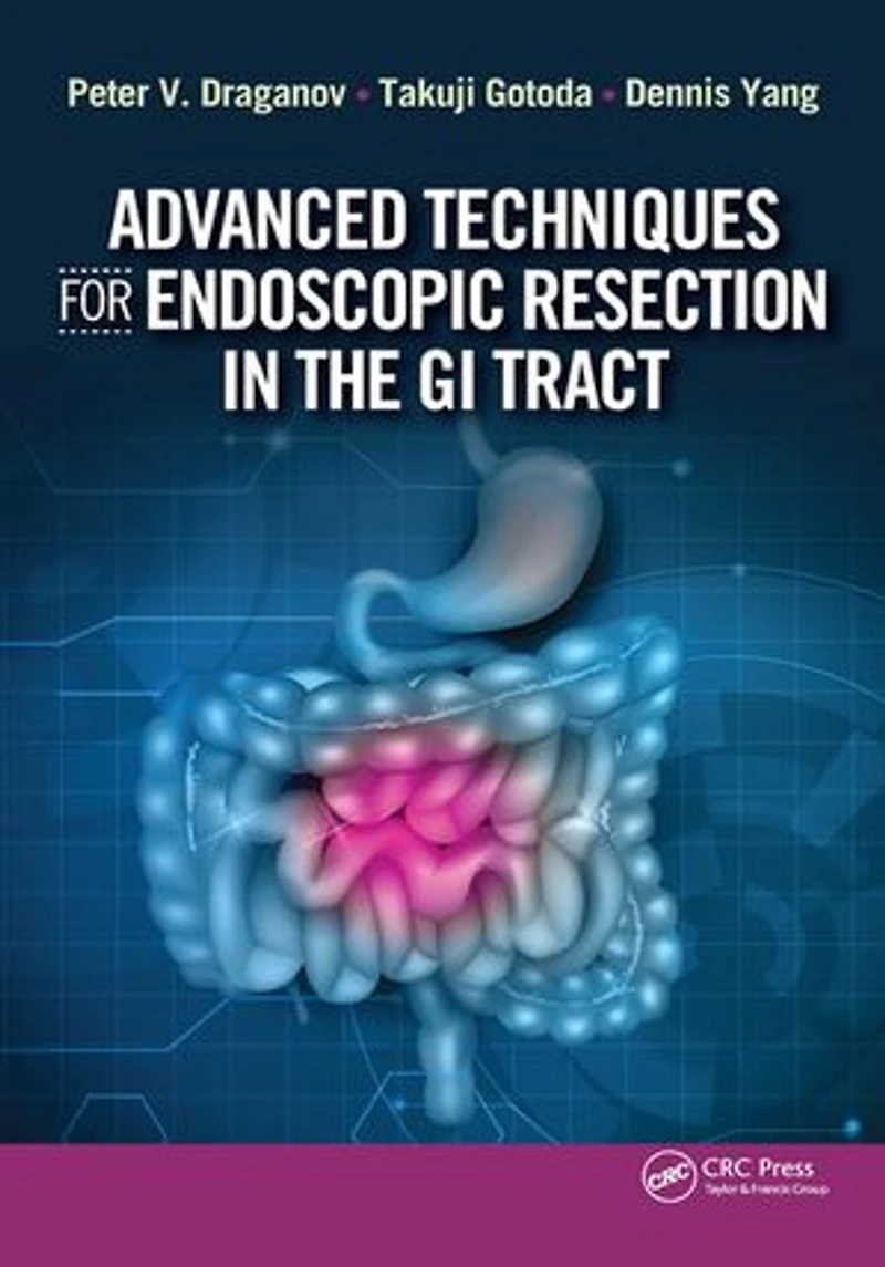 Advanced Techniques for Endoscopic Resection the GI Tract