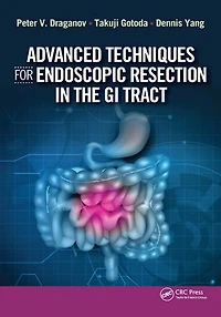 Advanced Techniques for Endoscopic Resection the GI Tract