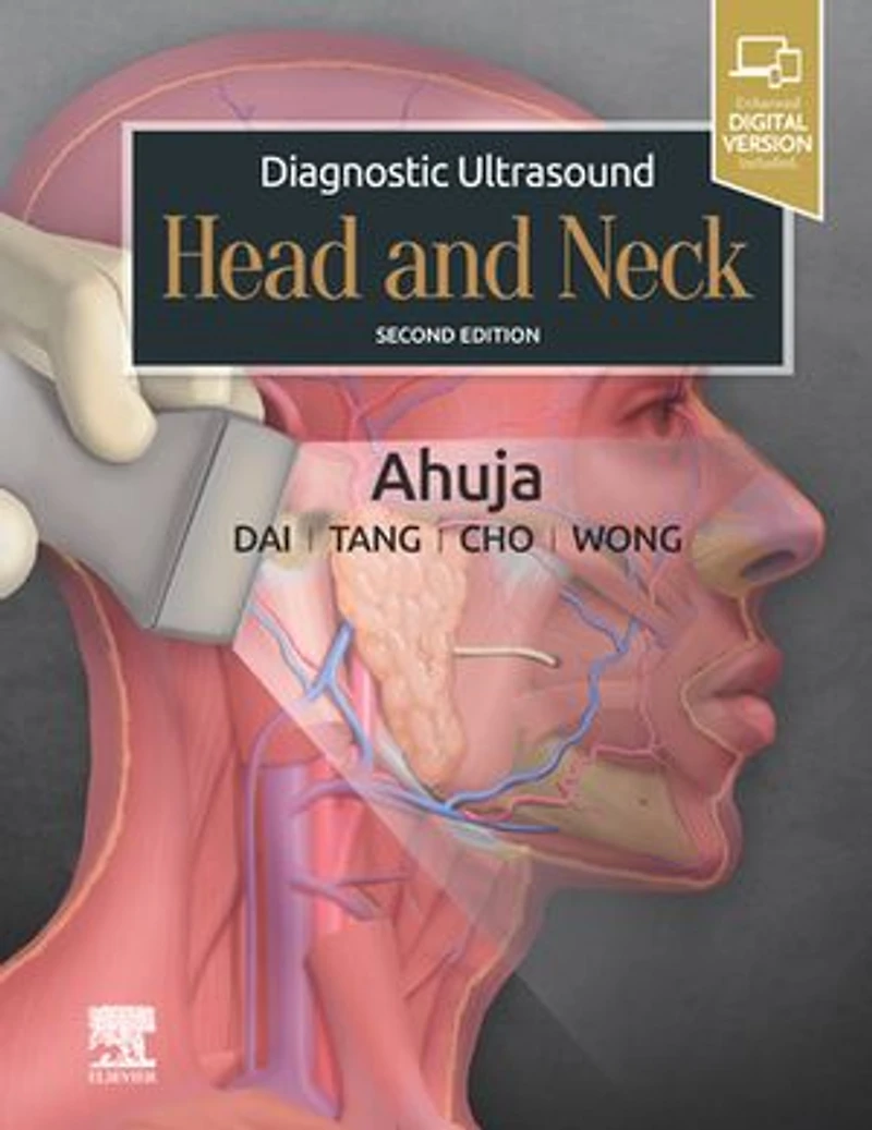 Diagnostic Ultrasound: Head and Neck E-Book: Diagnostic Ultrasound: Head and Neck E-Book